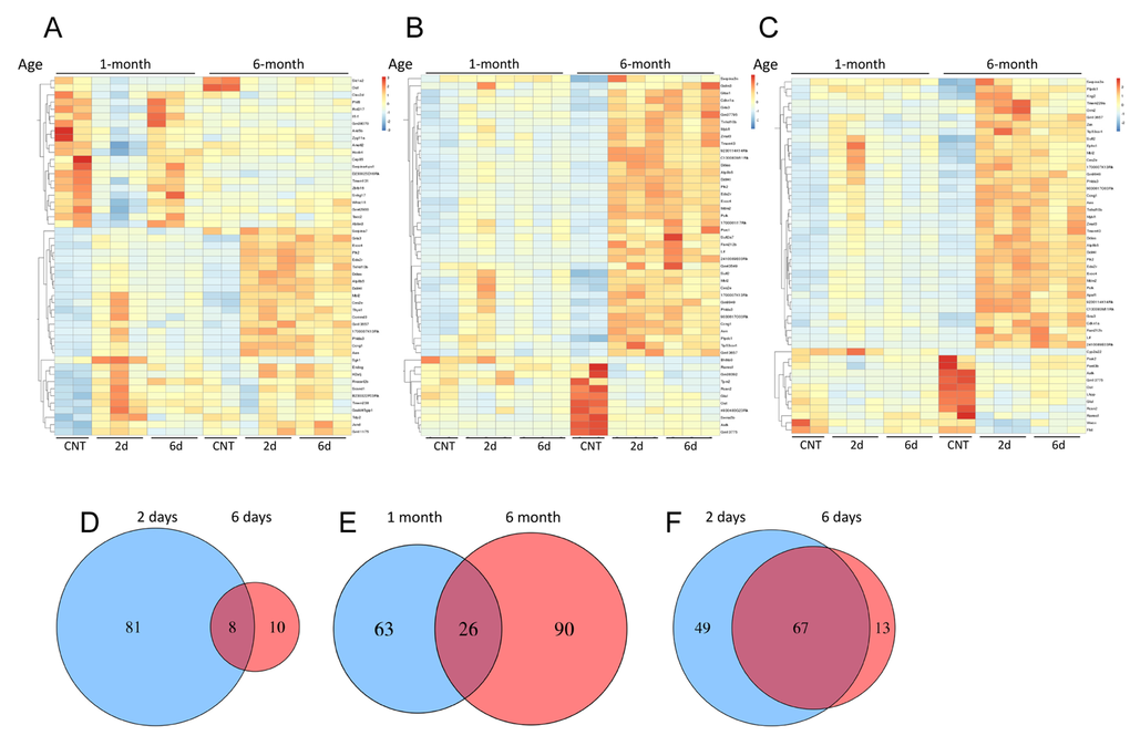 DEN-induced, age-dependent differential gene expression profiles. Heat maps depicting RNAseq gene expression profiles of mouse liver after DEN treatment. Hierarchical clustering analysis of top 50 differentially expressed transcripts in mouse livers 2 days after DEN treatment compared to control untreated livers in 1-month-old mice (A), 6-month-old mice (B) or genes differentially expressed at day 6 after DEN treatment compared to control in 6-month-old mice (C). Venn diagrams show the number of genes detected as differentially expressed by the DESeq2 package. (D) Comparing day 2 to day 6 in 1-month-old mice. (E) Comparing day 2 in 1-month and 6-month-old mice. (F) Comparing day 2 to day 6 in 6-month-old mice; demonstrating resolution of the response in day 6 in 1-month but not 6-month old mice with relative little overlap in the transcriptional response between the two ages at day 2.