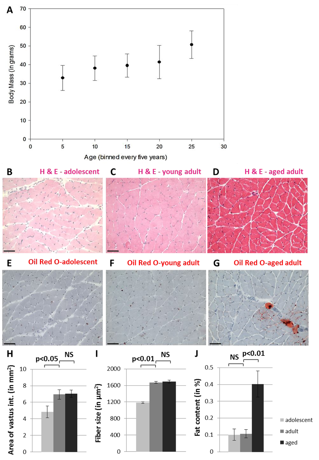 Naked mole-rats do not undergo muscle atrophy during the first twenty years of life. NMR body size continues to grow into late middle age (A). Hematoxylin and eosin staining shows grossly normal quadriceps skeletal muscle in adolescent (B), young adult (C), and aged adult (D) NMR. Tissues from adolescent (E), young adult (F), and aged adult (G) NMR quadriceps muscle tissues stained with Oil Red O demonstrate fat deposits. Cross-sectional area of the entire vastus intermedius muscle increases significantly between adolescents and young adults, but does not change upon further aging (H). Individual skeletal muscle fibers grow significantly larger during maturation but do not change upon further aging (I). Fat content of the entire vastus intermedius muscle increases significantly during late adulthood (J). Scale bars signify 100 microns.