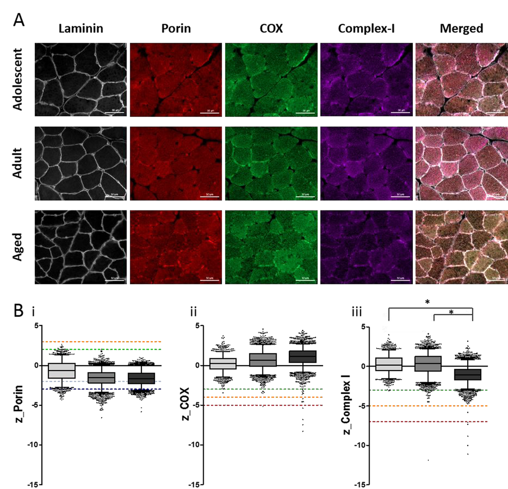 Quantitative quadruple immunofluorescence analysis reveals age-associated decreases in Complex I expression and no significant change in Complex IV expression. (A) 10µm sections NMR skeletal muscle (quadriceps) stained for (left to right) laminin, VDAC (porin), MTCOI (COX) and NDUFB8 (complex-I), scale bar 50µm. (B) Boxplots for NMR grouped as adolescent (light grey, n=4), adult (middle grey, n=7) or aged (dark grey, n=4), where boxes represent the first quartile, median and third quartile, and whiskers show the 5th and 95th percentiles of z-scores for (i) porin (z3=very high, above orange dotted line), (ii) COX (z-3= COX-positive, above green dotted line), and (iii) complex-I (z-3= CI-positive, above green dotted line). Kruskal-Wallis test shows significant difference in complex-I levels between the three groups (p=0.023). A Mann-Whitney test confirms significant decrease in complex-I levels from adolescent to aged group (p=0.034) and adult to aged group (p=0.0182), shown by *.