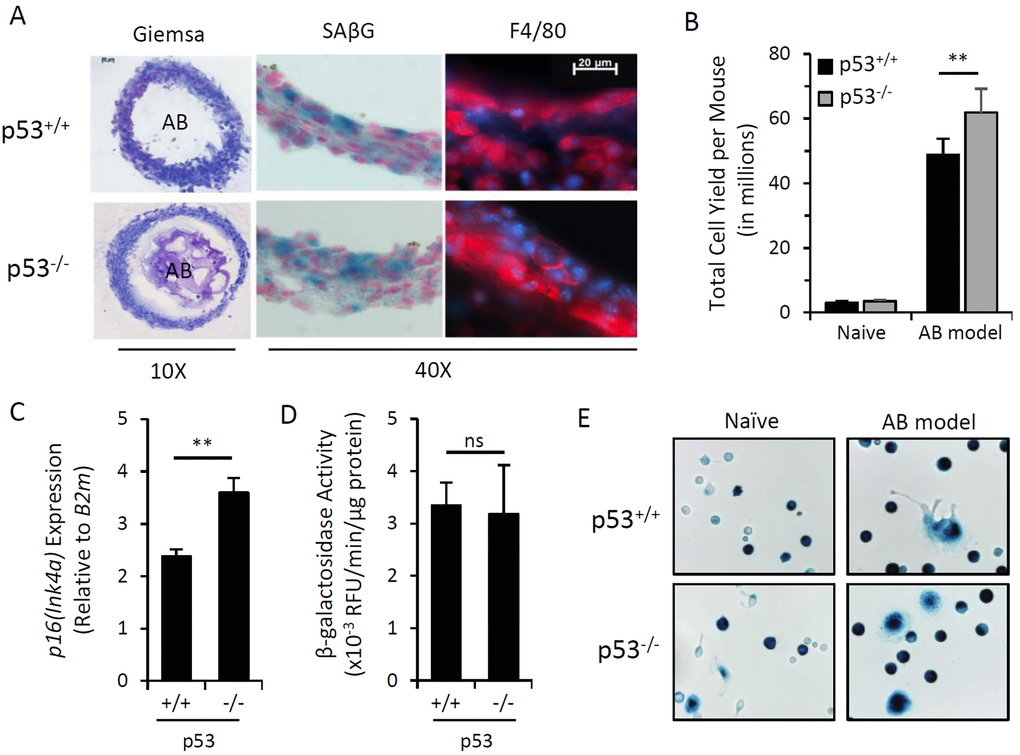 Induction of p16Ink4a and SAβG in macrophages does not require p53. Peritoneal lavage and alginate beads containing SCs (AB) were recovered from wild type (p53+/+) or p53 knockout (p53-/-) mice 15 days after injection (AB model). (A) Representative microphotographs of cryosectioned immunocyte capsules surrounding alginate beads stained with May-Grünwald-Giemsa for histology (10x objective), X-Gal substrate for β-galactosidase activity (SAβG; pH 6.0) (blue) with nuclear fast red counterstain (red), and an immunofluorescent antibody against macrophage marker F4/80 (red) with DAPI nuclear counterstain (blue) (40x objective). (B) Total yield of cells recovered from peritoneal lavage from naïve or AB-injected p53+/+ and p53-/- mouse strains. (C) AB model-elicited immunocyte capsules were pooled equally from 3 mice and p16Ink4a gene expression relative to internal reference gene β2-microglobulin (B2m) was measured by qPCR. (D) β-galactosidase activity from cell extracts of immunocyte capsules from alginate beads recovered from individual mice was measured via 4-MUG hydrolysis, presented as the rate of 4-MU fluorescence (RFU) per minute normalized per microgram of protein. (E) Representative microphotograph of adherence-selected peritoneal lavage from naïve and AB-injected mice stained with X-Gal for SAβG activity. Data show mean ± standard deviation of two independent experiments (n=3 mice per experiment). Statistical comparison between p53+/+ and p53-/- strains are indicated; ns, not significant; **, p-value 