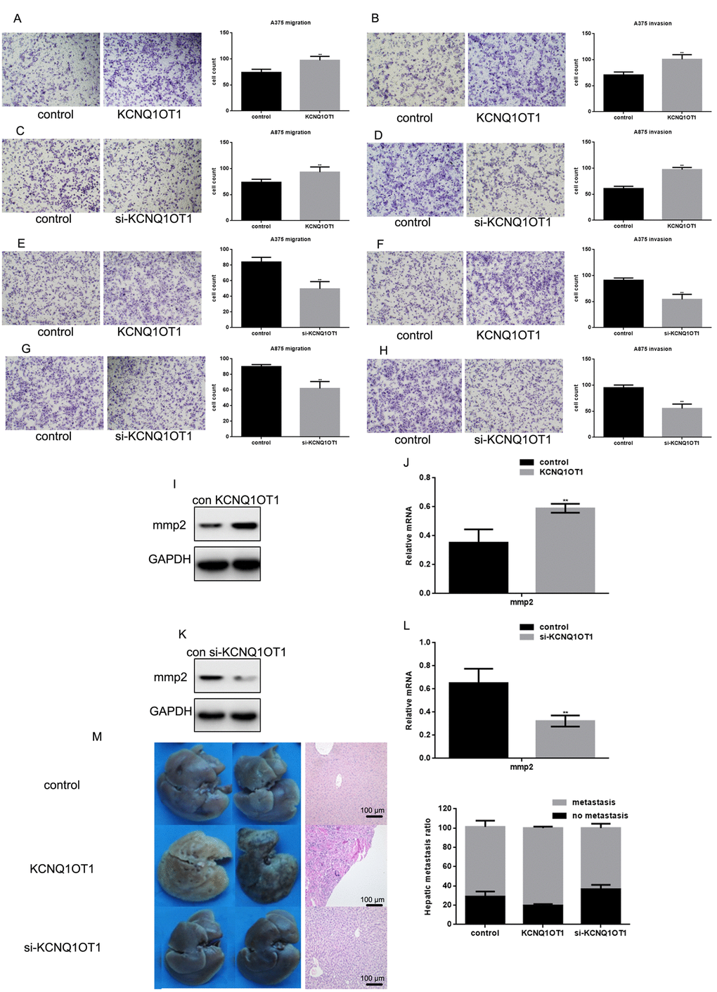 KCNQ1OT1 promotes melanoma cell metastasis. (A, B) After transfecting KCNQ1OT1/control in A375 cells and (E, F) A875 cells, transwell assays with or without matrigel were performed. Cells were counted and results represent the mean ± SD of three experiments. ** P C, D) After transfecting si-KCNQ1OT1 or control in A375 cells and (G, H) A875 cells, transwell assays with or without matrigel were performed. Cells were counted and results represent the mean ± SD of three experiments. ** P I, J) After transfecting KCNQ1OT1/control or (K, L) si-KCNQ1OT1 in A375 cells, MMP2 protein and mRNA level was detected by western blot and real time PCR. Data are shown as mean ± SEM. ** P M) 2×106 A375 cells with stable expression of vector (control), KCNQ1OT1, and si-KCNQ1OT1 were injected into nude mice via the tail vein. Livers were dissected and either macroscopically photographed (left) or stained with H&E (middle, Scale bar, 100μm). The right side is the HE staining results of the liver (right).