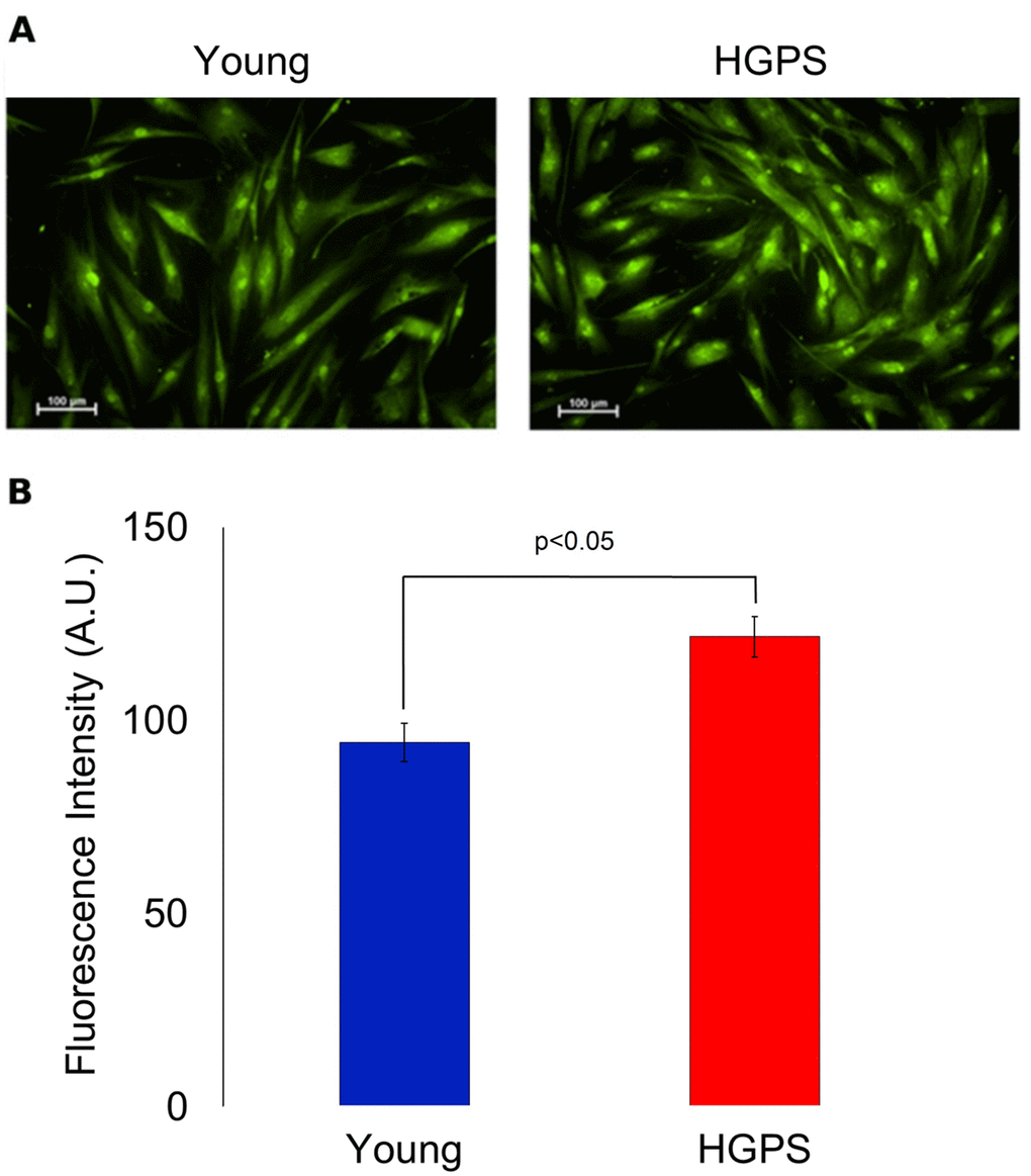 Immunofluorescence detection for BKCa channels expressed on plasma membrane in fixed cells. (A) Fluorescence micrographs of isolated hDF obtained from young and HGPS donors incubated with an anti-BKCa α subunit primary antibody visualized by FITC-conjugated secondary antibody and acquired at 200× magnification. Scale bars: 100 μm. (B). Quantification of mean fluorescence intensity of anti-BKCa antibody-stained cells. The green fluorescence intensity values are obtained from 30 cells (A.U. ± SEM). Significant differences calculated according to the Student’s t-test (p
