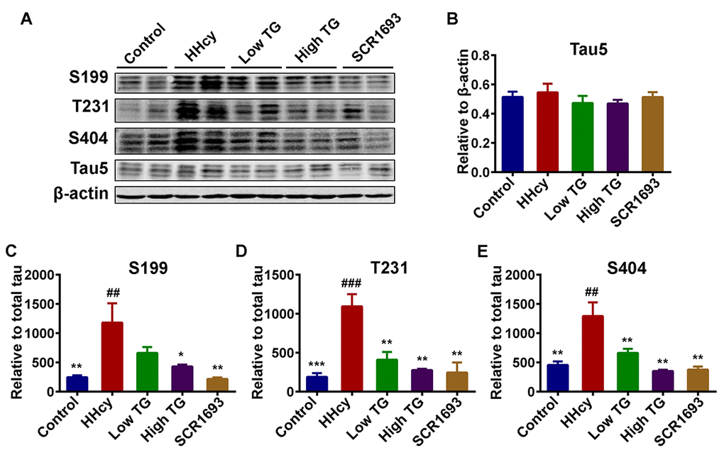 Treatment with TG mitigated Hcy-induced tau hyperphosphorylation. (A) Phosphorylation status of tau protein as measured by Western blotting in the hippocampus after Hcy treatment and TG supplementation. (B) Total tau (Tau5) normalized to β-actin. (C-E) Quantitative analysis of the blots of phosphorylated tau probed with several phosphorylated-tau antibodies normalized to total tau (Tau5). A significant decrease in tau hyperphosphorylation at several studied sites was seen following TG administration. The data were expressed as mean ± SEM (n = 6). ## P 