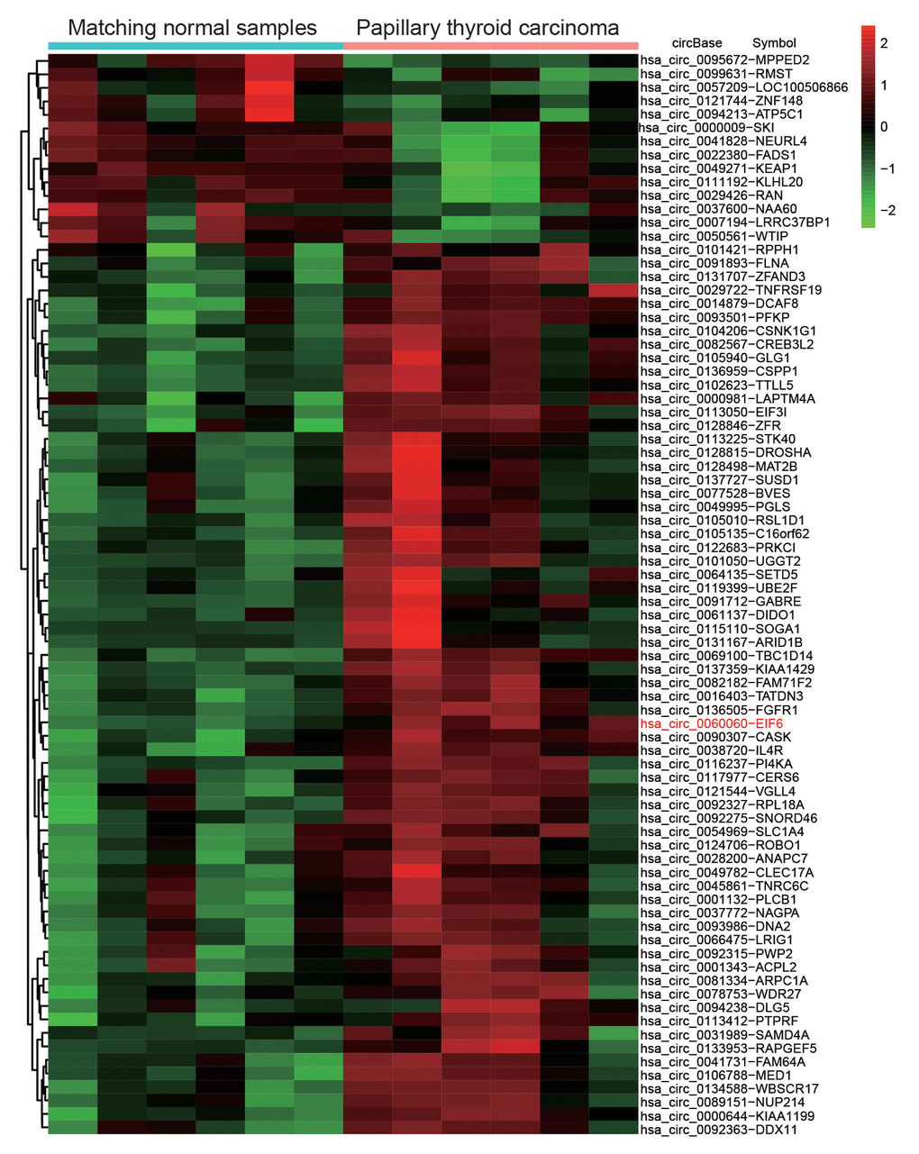 Differential expression analysis of circular RNAs showed circEIF6 was highly expressed in papillary thyroid carcinoma. Heat map was generated by differential expression analysis of circular RNAs with GEO data (GEO accession: GSE93522) and revealed circEIF6 was highly expressed in papillary thyroid carcinoma.