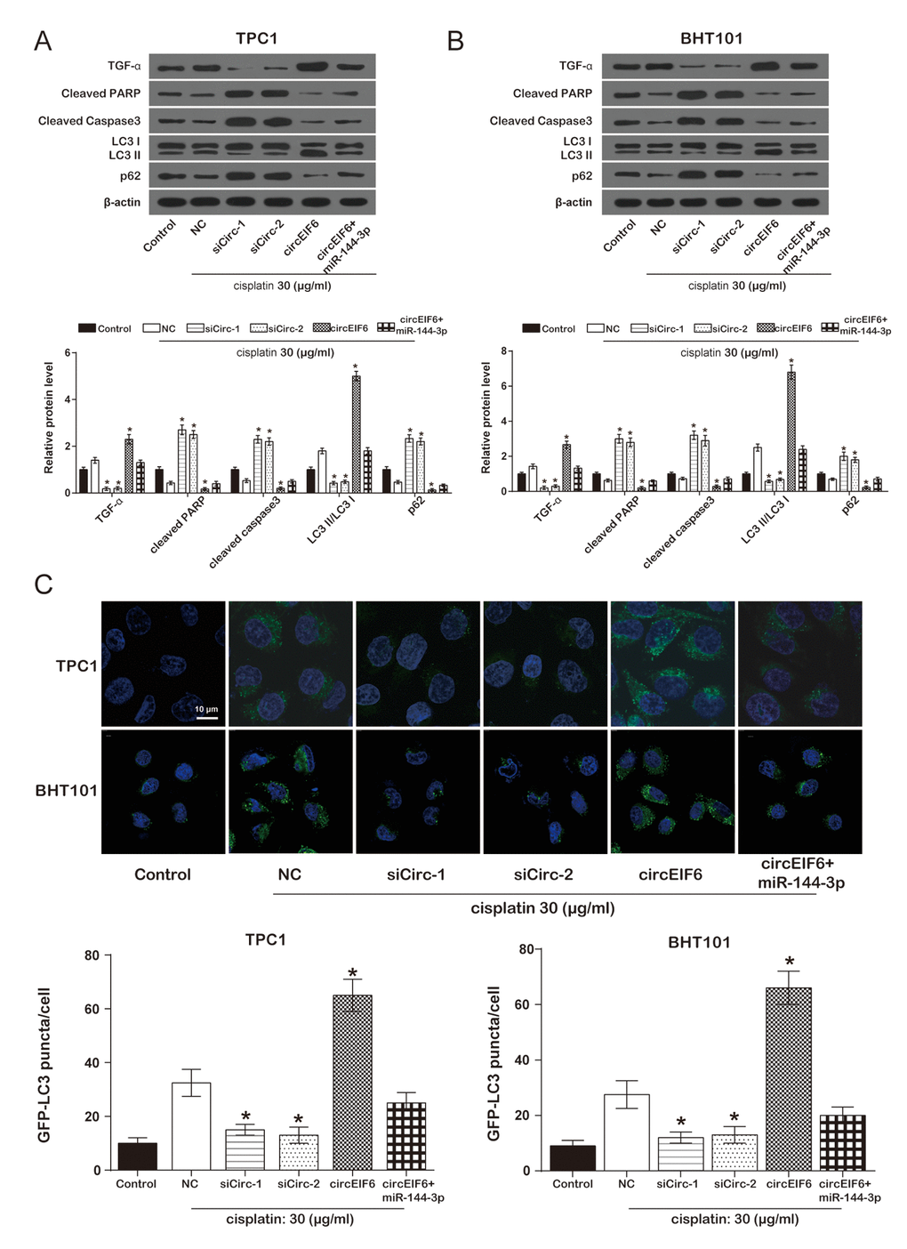 Overexpression of circEIF6 could enhance autophagy and inhibit apoptosis in the TPC1 and BHT101 cells with cisplatin treatment. (A) Western blot was used to detect the protein of TGF-α, cleaved PPAR, cleaved caspase3, LC3B, p62 expressions. Cleaved PARP and caspase-3 were proteins related to apoptosis; LC3 II/LC3 I ratio and p62 were related to autophagy. *P B) GFP-LC3 puncta was less in siCirc-1 or siCirc-2 group and more in circEIF6 group after treated with cisplatin, *P 