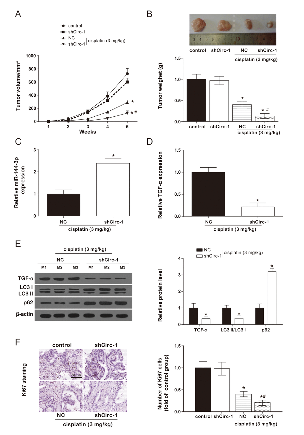 CircEIF6 knock-down enhanced cisplatin sensitivity of BHT101 cells in vivo. (A and B) Tumor formation curve and tumor weight quantification showed circEIF6 knockdown played a better anti-tumor effect in cisplatin-treated nude mice. *P #P C and D) Increase of miR-144-3p and reduction of TGF-α were detected in circEIF6 knockdown group with cisplatin treatment. *P E) TGF-α and LC3 II/ LC3 I ratio was lower, while the expression of p62 was much higher in the cisplatin+shCirc-1. *P F) The cell proliferation marker, Ki67, was detected with Immunohistochemistry, which was significantly fewer with cisplatin treatment and was obviously decreased by circEIF6 knock-down under the cisplatin treatment. *P #P 