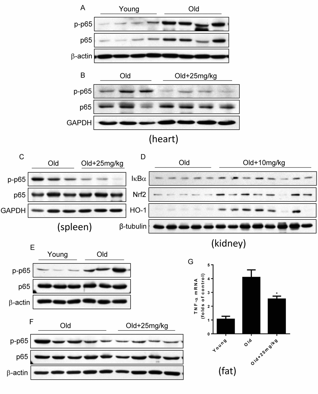 DMAMCL treatment suppresses NF-κB activities in multiple tissues and organs in old mice. The total protein was isolated from the heart, spleen, kidney, and fat tissues. The p-p65 and p65 protein expression levels in heart (A and B), and in spleen (C), the expression levels of IκBα, HO-1 and Nrf2 in kidney (D), and p-p65 and p65 protein expression levels in fat (E and F), were examined by Western blot (n=3-8). (G) TNF-α mRNA levels in fat tissue were detected by qRT-PCR. Data are represented as the mean ± SEM. *P 