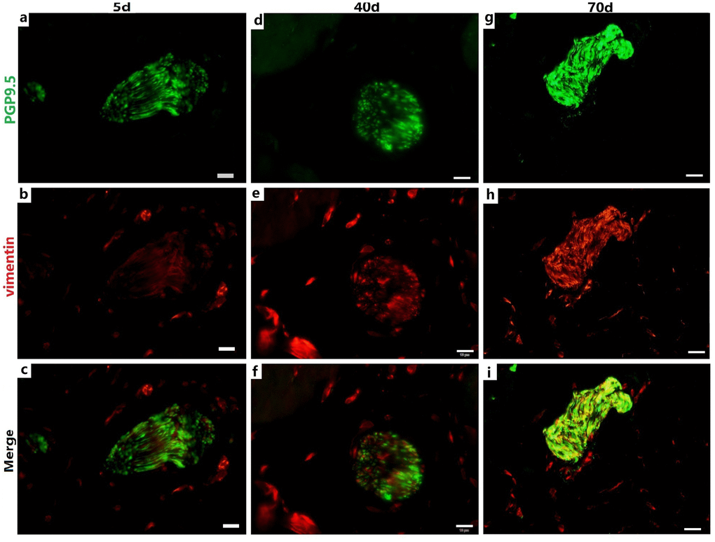 Relationship between PGP9.5-positive nerve trunks (green) and ICs (red) in the rumen MP with age. Several ICs surrounding a nerve trunk formed a ring-boundary layer, while most ICs interlaced with PGP9.5-positive NFs in the internal nerve trunks. The ICs ring-boundary layer tends to be seamless and gradually closer to the nerve trunk. (Bar =10 μm a–i.)