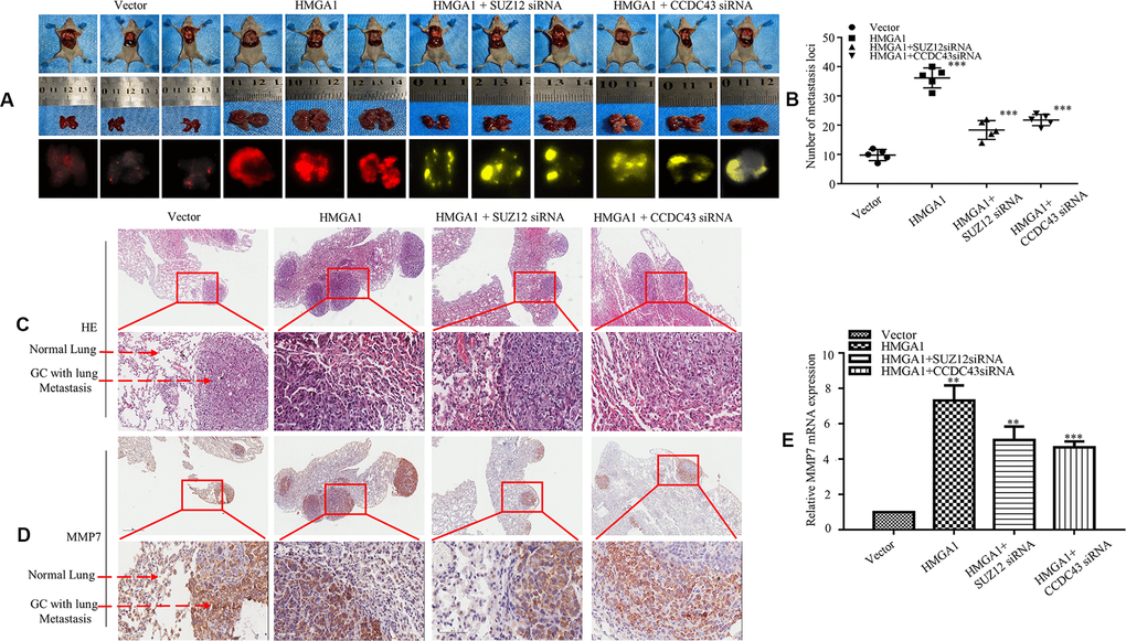 SUZ12/CCDC43 is necessary for HMGA1-induced GC metastasis in vivo. (A) Whole-body fluorescence imaging of GC progression in mice (n = 3). Images of metastatic loci in the lungs by arrows. (B) Number of metastatic loci in lung was counted. ***, P C) H&E staining of lungs was performed in samples from mice. (D) MMP7 expression in the lung metastasis of GC was detected by IHC. (E) Expression of MMP7 in lung tumours derived from AGS cells was determined by qRT-PCR. **, P C, D).