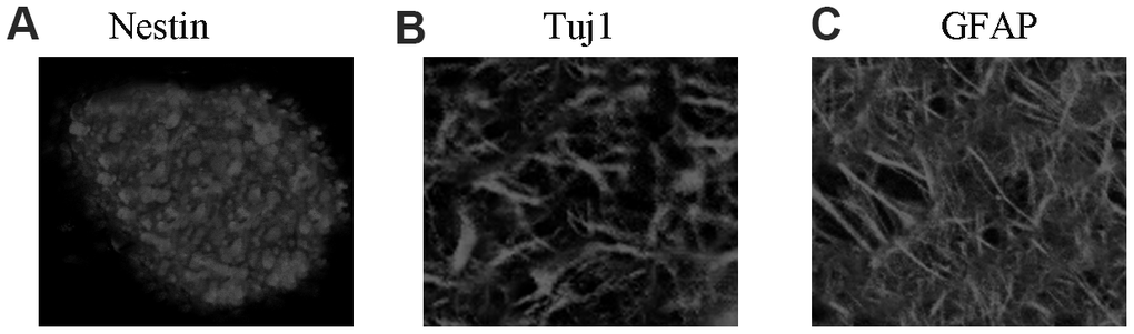 NSC identification and culture. (A) Immunocytochemical staining of purified neural stem cells with Nestin. (B) Immunocytochemical staining of neurons with Tuj1. (C) Immunocytochemical staining of astrocytes with GFAP.