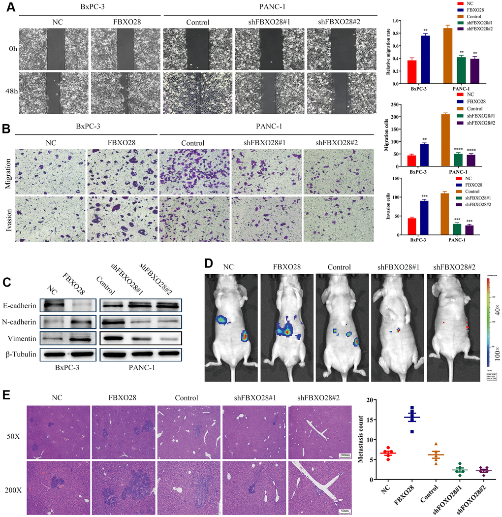Overexpression of FBXO28 promotes invasion and migration of pancreatic cancer cells. (A) At 24 hours after scratching, the migratory capacity of PANC-1 and BxPC-3 cells was assessed using the wound healing assay. (B) Transwell assay evaluation of BxPC-3 and PANC-1 cell invasion and migration. (C) Western blot to verify the expression of FBXO28 and epithelial-mesenchymal transition (EMT)-related proteins. (D) The cells were injected into the spleen to establish a liver metastasis model in the mice according to grouping, and live imaging was performed. (E) Hematoxylin-and-eosin (HE) staining of liver metastases (magnification: ×50, ×200). **P 