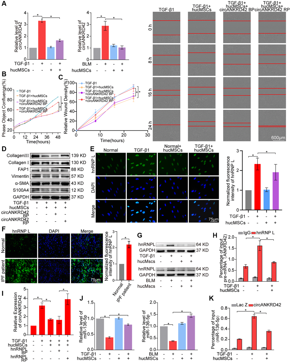 hucMSCs treatment alleviated pulmonary fibrosis by preventing circANKRD42 reverse splicing biogenesis. (A) qRT-PCR result illustrated that hucMSCs treatment reduced the expression level of circANKRD42 compared with TGF-β1/BLM treatment in vivo and in vitro. (B) Rescue experiment of cell proliferation showed that hucMSCs treatment reduced the TGF-β1-induced cell proliferation. circANKRD42 overexpression increased the cell proliferation and reversed the downward trend caused by hucMSCs treatment. (C) Rescue experiment of cell scratch assay monitored with an IncuCyte S3 instrument validated that hucMSCs treatment blocked the cell migration. circANKRD42 overexpression promoted the cell migration and reversed the downward trend caused by hucMSCs treatment. (D) Rescue experiment showed that hucMSCs treatment reduced the expression of S100A4, FAP1, α-SMA, vimentin, and collagen I and III. circANKRD42 overexpression increased the expression of S100A4, FAP1, α-SMA, vimentin, and collagen I and III and reversed the downward trend caused by hucMSCs treatment. (E) Immunofluorescence images exhibited that hnRNP L was located in the nucleus and its expression decreased in the hucMSCs treatment group compared with that in the TGF-β1 group. (F) Example of hnRNP L immunofluorescence images depicted that hnRNP L expression was increased in patients with IPF compared with that in normal individuals. (G) Western blot analysis identified that hucMSCs treatment inhibited hnRNP L expression compared with that in the TGF-β1/BLM group in vivo and in vitro. (H) RIP uncovered that hnRNP L bound to pre-mRNA (ANKRD42) and hucMSCs treatment reduced the binding amount of hnRNP L with pre-mRNA (ANKRD42). (I) qRT-PCR was performed to prove that the inhibitory effect of hucMSCs on circANKRD42 depending on hnRNP L. (J) MiR-136-5p expression markedly decreased in the TGF-β1/BLM group and increased in the hucMSCs treatment group in vivo and in vitro. (K) RAP experiment showed that miR-136-5p was enriched in circANKRD42; this enrichment was intensified by TGF-β1 and decreased by hucMSCs treatment. Lac Z was the control. BP indicates blank plasmid, and RP indicates the recombinant plasmid of overexpressed circANKRD42. Each bar represents the mean ± SD; n = 6; *p 