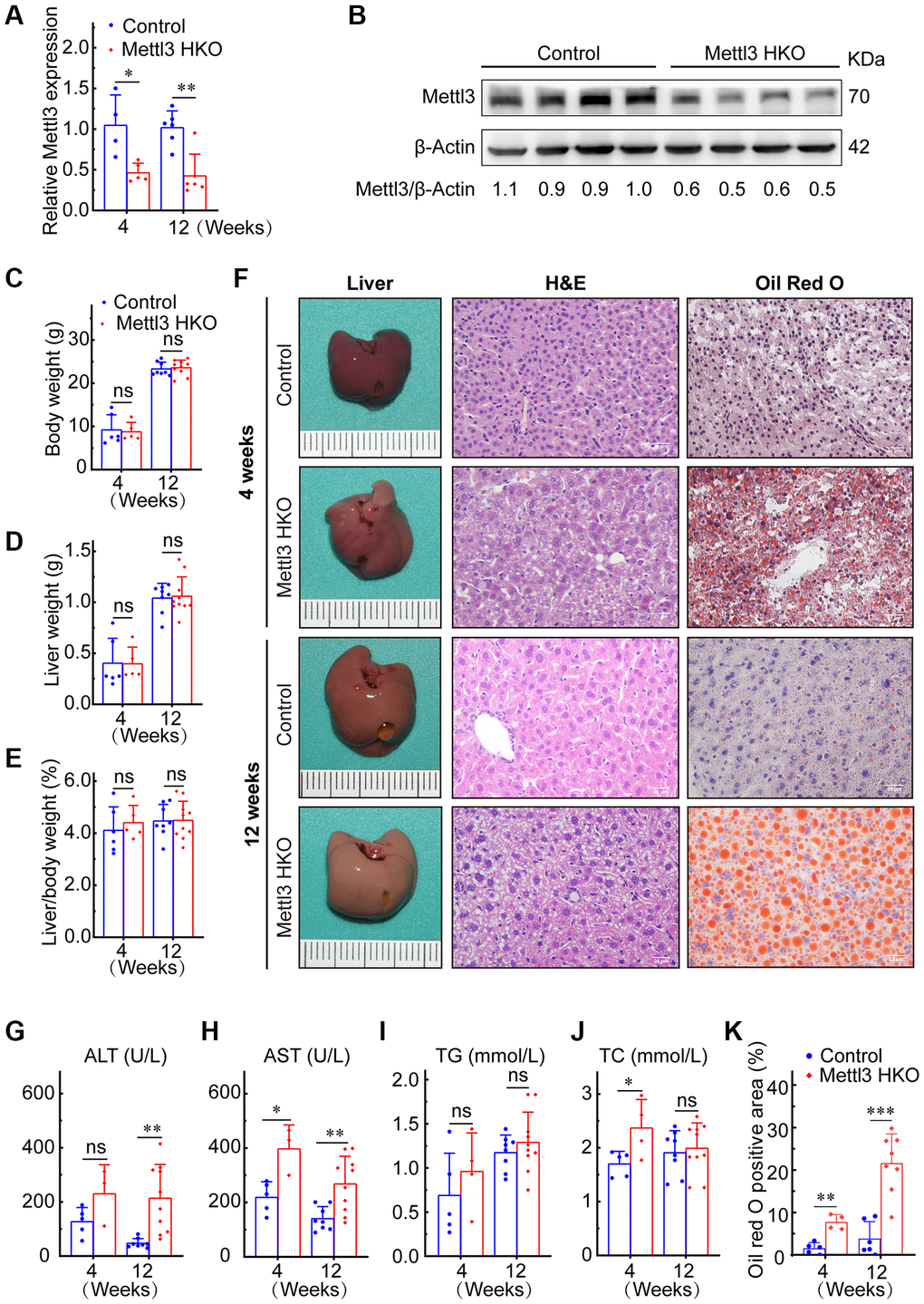 Hepatocyte-specific deletion of Mettl3 induces lipid accumulation in mouse liver cells. (A) qRT-PCR assay of the relative Mettl3 expression in control and METTL3 HKO mouse livers at 4 and 12 weeks. (B) Representative Western blot analysis and quantitative results in control and METTL3 HKO mouse livers. (C–F) Body weight (C), liver weight (D), and liver-to-body weight ratio (E) of METTL3 HKO and control mice at 4 and 12 weeks. (F) Representative images of the livers of METTL3 HKO (n = 5 for 4 weeks; n = 10 for 12 weeks) and control mice (n = 6 for 4 weeks; n = 8 for 12 weeks) stained with hematoxylin and eosin and Oil red O. Scale bars, 25 μm. (G–K) Serum levels of ALT (G), AST (H), TG (I), TC (J), and Oil red O positive area (K). Data are presented as mean ± SD. Abbreviations: TG: triglyceride; TC: total cholesterol; ns: not significant; *P **P ***P 