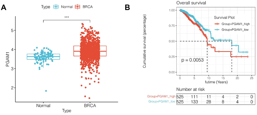 Expression and survival analysis of PGAM1. (A) PGAM1 expression was upregulated in breast cancer compared with normal controls. (B) Survival analysis showed that the prognosis of breast cancer patients with high PGAM1 expression was significantly worse (p