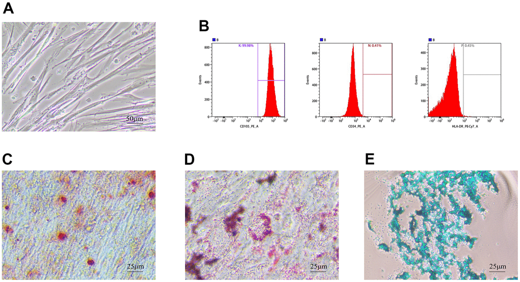 Identification of hUMSCs. (A) hUMSCs of the 4th-5th generation were observed under the light microscope. (B) hUMSC specific surface markers, CD105, CD34, and HLA-DR, were measured by flow analysis. (C–E) Osteogenesis (C) adipogenesis (D) and chondrogenesis (E) were identified after staining.