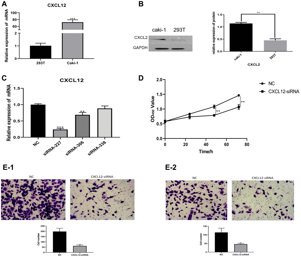 The mRNA expression of CXCL2 was measured using Q-PCR (A). The protein expression of CXCL2 was measured using western blotting (B). In the caki-1 cell line, the down-regulation of CXCL2 was performed (C). The impact of CXCL2 down-regulation on cell proliferation was measured using CCK-8 assay (D). The impact on migration (E-1) and invasion (E-2) was measured using Transwell assay.