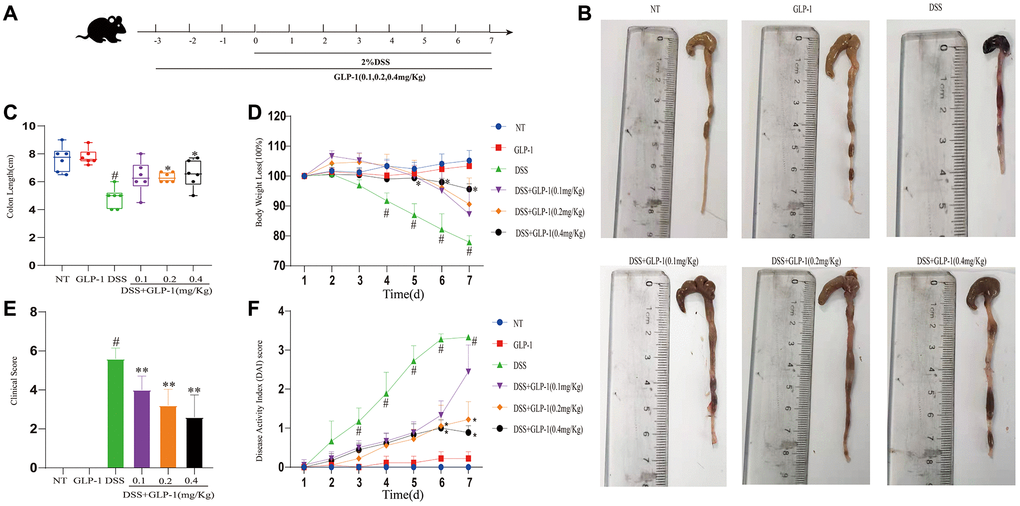 GLP-1 alleviates DSS-induced colitis symptoms in mice. (A) GLP-1 treatment on the DSS-induced colitis mouse model. (B) The integral colon images. (C) The total colon length. (D) Bodyweight loss. (E) Clinical score. (F) DAI score. Data are presented as mean ± SD (n = 6 per group). For GLP-1-DSS vs. DSS group, *p **p #p 