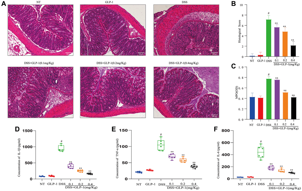 GLP-1 improves DSS-induced colitis damage in mice. (A) H&E-stained sections (100X). (B) Histopathological scores. (C) MPO activities. (D) The levels of IL-1β in colonic tissues. (E) The levels of TNF-α in colonic tissues. (F) The levels of IL-6 in colonic tissues. Data are presented as mean ± SD (n = 6 per group). For GLP-1-DSS vs. DSS group, *p **p #p 