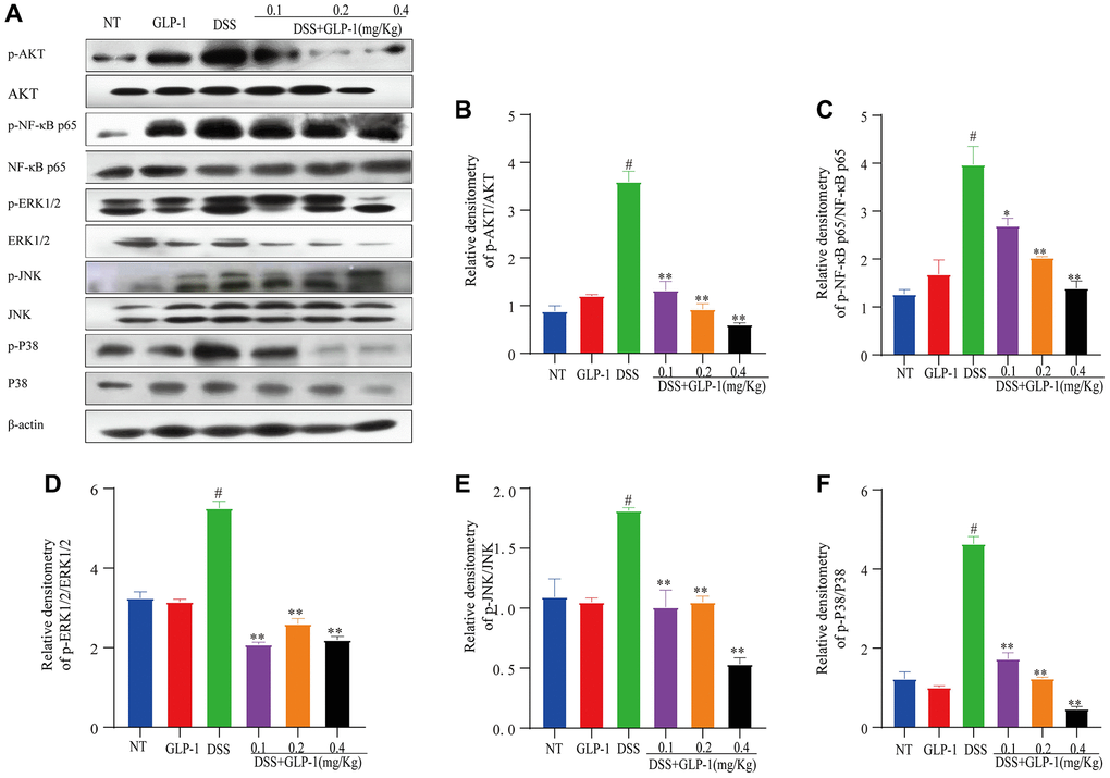 Effect of GLP-1 on the phosphorylation of AKT/NF-κB p65 and MAPK in DSS-induced colitic mice. The protein levels of p-AKT (A, B), p-NF-κB p65 (A, C), p-ERK1/2 (A, D), p-JNK (A, E) and p-P38 (A, F) were analyzed by western blotting. Data are presented as mean ± SD (n = 6 per group). For GLP-1-DSS vs. DSS group, *p **p #p 