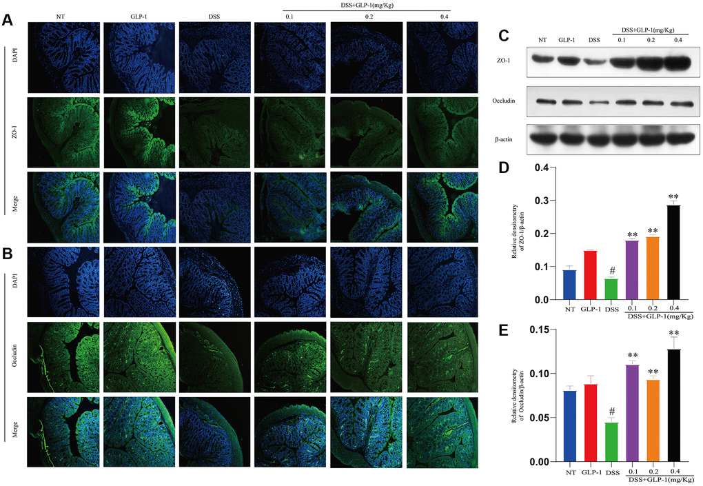 GLP-1 restores the intestinal barrier function in DSS-induced colitic mice. The protein levels of ZO-1 (A) and Occludin (B) were analyzed by immunofluorescence in the colon tissue. The protein expression of ZO-1 (C, D) and Occludin (C, E) were analyzed by western blotting. Data are presented as mean ± SD (n = 6 per group). For GLP-1-DSS vs. DSS group, *p **p #p 