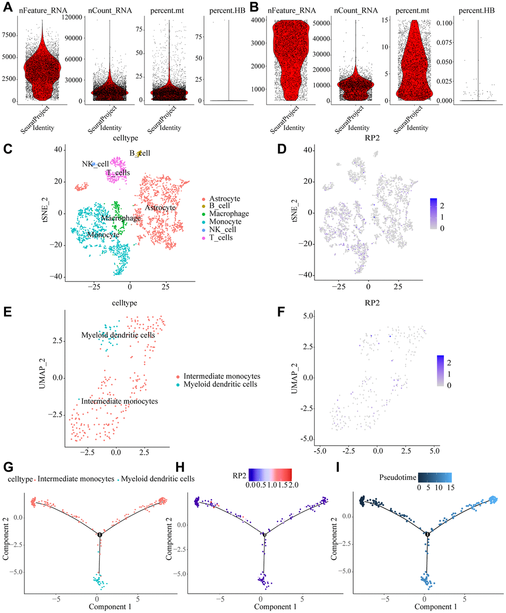 Macrophage dynamics in glioma progression. (A, B) Quality control removal of low-quality cells (C) tSNE cell cluster analysis differentiating cell types in the tumor microenvironment. (D) Tumor cells were divided into 13 clusters showing RP2 expression sites in the tumor microenvironment. (E) Cell reclustering was performed by UAMP method, and macrophage types were analyzed. (F) expression of RP2 was shown in the reclustering cells. (G) Evolutionary tracks of all kinds of cells after dimension reduction (H) expression of RP2 changes with pseudo time (I) differentiation tracks of macrophages in glioma, with cluster color code.