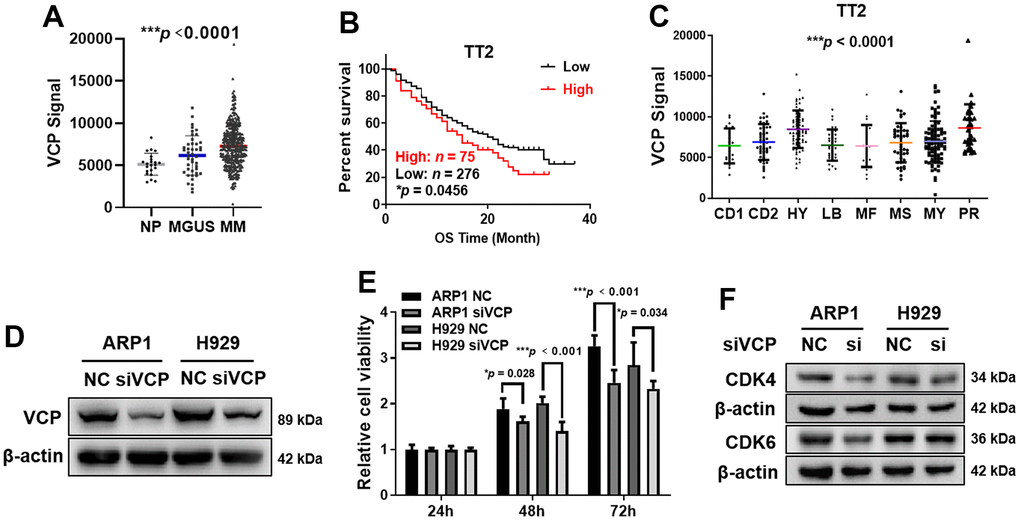 Elevated VCP is associated with poor survival in MM patients and siVCP inhibits MM cell proliferation in vitro. (A) VCP mRNA levels were significantly increased in MM samples (n = 351) compared with NP (n = 22) and MGUS (n = 44) samples. (B) Higher VCP level was associated with a shorter OS in TT2 cohort (n = 351, High: n = 75, Low: n = 276). (C) Box plot representing VCP expression in eight MM subgroups from TT2 cohort. (D) WB analysis of VCP expression in siVCP cells. (E) MTT assay examined the effect of siVCP on MM cell proliferation. (F) WB analysis showed that siVCP inhibited CDK4/6 expression in MM cells. The MM patient survival data were plotted by Kaplan-Meier curve, and the survival of patients with low and high expression of VCP was compared through a log-rank test. Data are presented as the mean ± SD; *p p p 