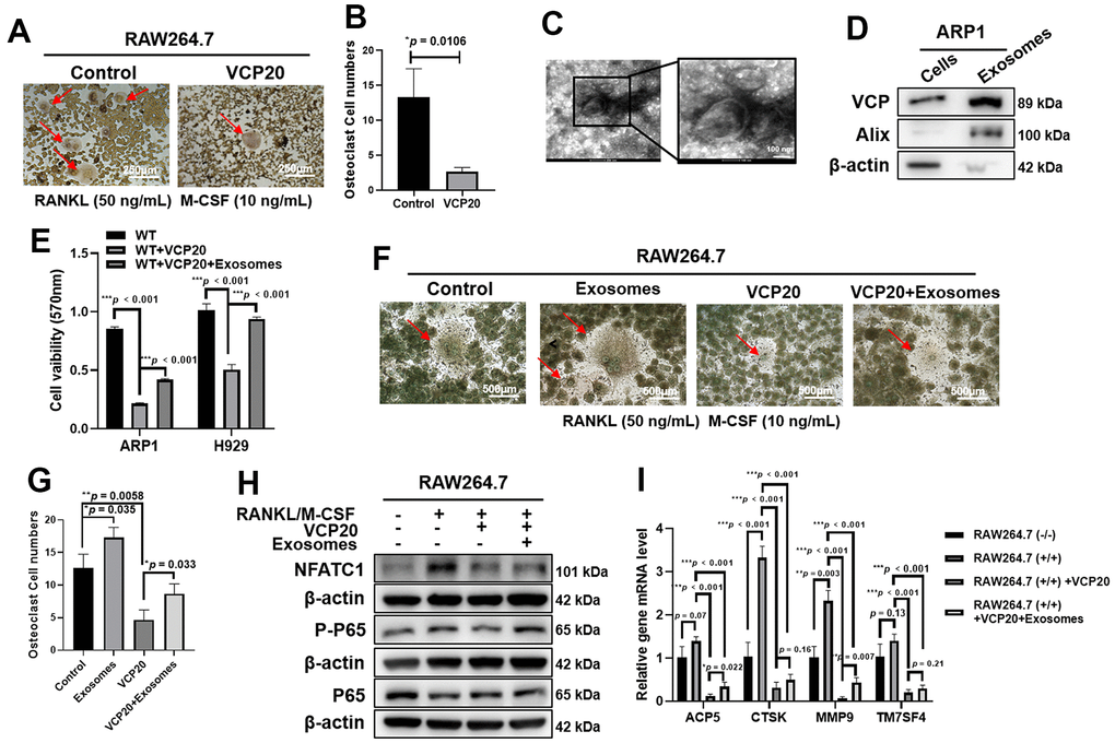 VCP20 inhibits osteoclast differentiation via downregulating NF-κB P65. (A) TRAP staining showed that VCP20 inhibited osteoclast differentiation in RAW 264.7 cells treated with RANKL and M-CSF. Scale bar: 250 μm. (B) Quantitative analysis of multinucleated osteoclasts. (C) The biological characteristics of exosomes were detected by transmission electron microscopy. Scale bar: 100 nm. (D) Detection of VCP, Alix and β-actin in ARP1 WT cells and exosomes from ARP1 WT cells by WB analysis. (E) Exosomes from ARP1 WT cells rescued cell proliferation inhibited by VCP20 in MM cells (1×106 MM cells were treated with 20 μg exosomes or not for 48 h). (F) TRAP staining revealed that exosomes from ARP1 WT cells induced osteoclast differentiation. Scale bar: 250 μm. (G) Quantitative analysis of multinucleated osteoclasts. (H) WB assay confirmed that exosomes from ARP1 WT cells increased the expressions of P-P65 and NFATC1 that were downregulated by VCP20 in RAW264.7 cells. (I) RT-PCR assay showed that VCP20 decreased the levels of osteoclast differentiation related markers, and this effect was partially compensated by exosomes from ARP1 WT cells. VCP20: 100 nM; exosomes: 2 μg/mL each well. Data are presented as the mean ± SD; *p p p 