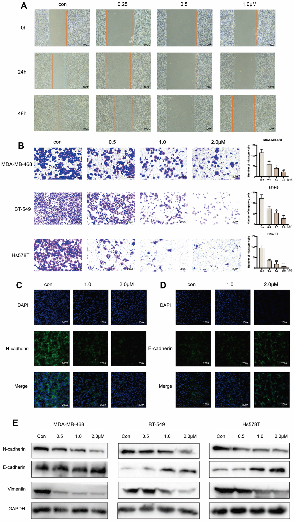 Acetyl-cinobufagin inhibits the migration of TNBC cells. (A) Wound healing assay was performed using the BT-549 cells with/without acetyl-cinobufagin treatment. (B) Transwell migration assay was performed with the MDA-MB-468, BT-549 and Hs578T cells. (C, D) Changes in the expression of EMT marker proteins (E-cadherin and N-cadherin) in Bt-549 cells were verified by immunofluorescence staining. (E) Expression of proteins related to the EMT signaling pathways as identified by Western blotting. *p p p 
