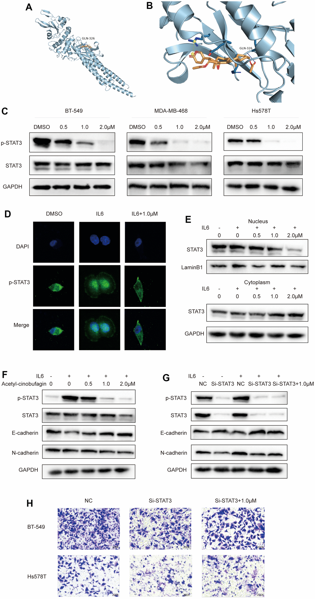 Acetyl-cinobufagin inhibits EMT through the STAT3 signaling pathway. (A, B) Molecular docking of acetyl-cinobufagin to the STAT3 binding sites. (C) Expression of proteins involved in the STAT3 signaling pathway as detected by Western blot analysis. (D) The subcellar location of STAT3 was examined by immunofluorescence staining and confocal laser scanning microscopy (CLSM) in BT-549 cells. (E) The levels of STAT3 protein in the cytoplasm and nuclei were determined by immunoblotting analysis after extraction from BT-549 cells. (F) BT-549 cells treated with IL6 for 30 min after treatment with acetyl-cinobufagin for 10-20 h; expression levels of proteins associated with STAT3 and EMT signaling pathways as detected by Western blot analysis. (G) STAT3 knockdown in BT-549 cells treated with control, IL6 or IL6 + acetyl-cinobufagin (1.0 μM), expression levels of proteins related to STAT3 and EMT signaling pathways as detected by Western blot analysis. (H) Evaluation of metastatic abilities of BT-549 and Hs578T after knockdown of STAT3.
