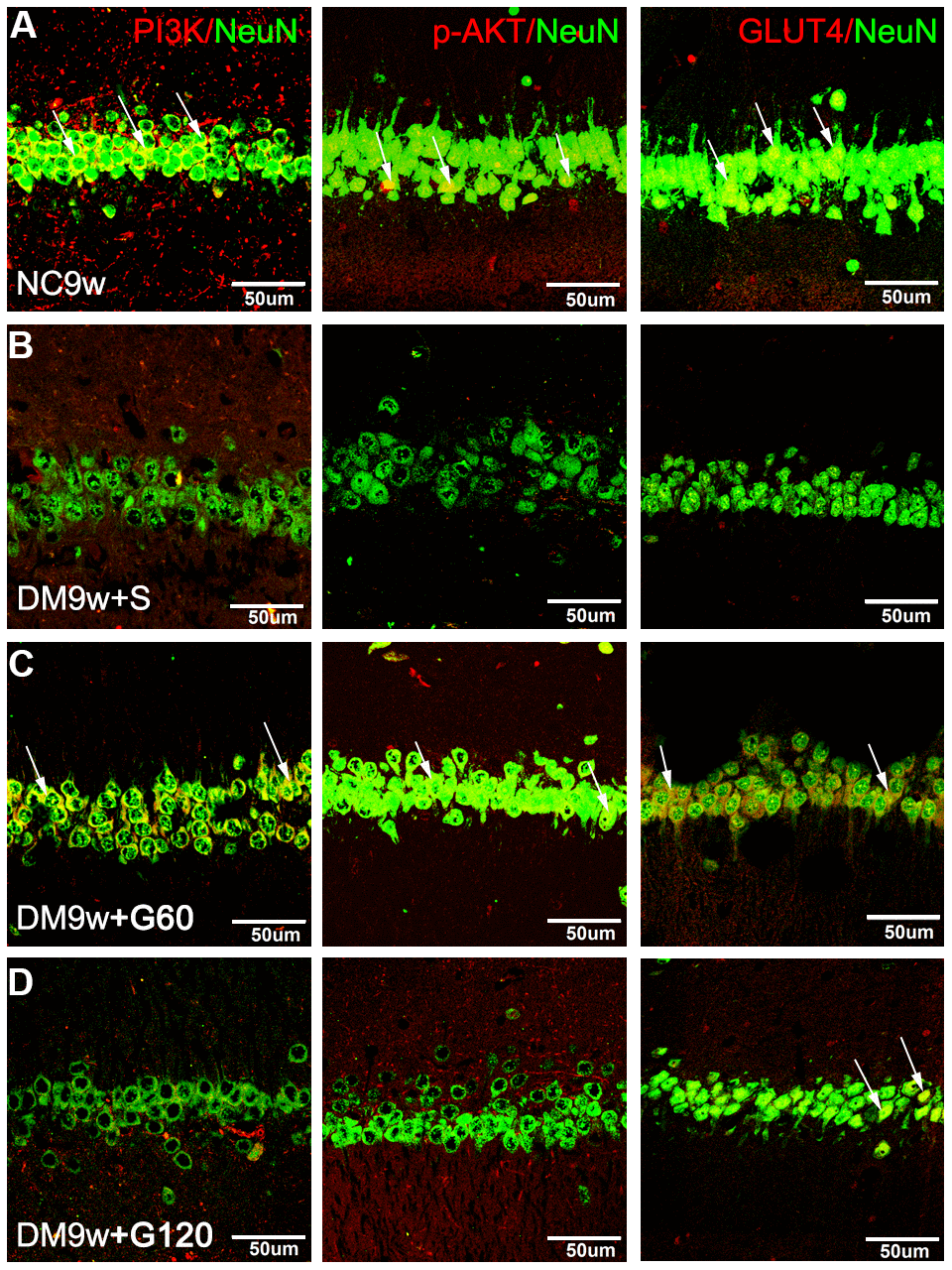 Gastrodin intervention restored the expression of PI3K/AKT/GLUT4 pathway in the hippocampal neurons of diabetic rats. Double immunofluorescence staining showed PI3K, p-AKT and GLUT4 positive neurons in the hippocampus of NC9w (A) DM9w+S (B) DM9w+G60 (C) and DM9w+G120 (D) groups. Note the diminution of these factors’ immunofluorescence in the neurons of the DM9w+S group as compared with the normal control. However, the immunofluorescence was restored to a level comparable to that of the normal in the DM9w+G60 group. White arrows indicated double positive cells. Bar = 50 μm.