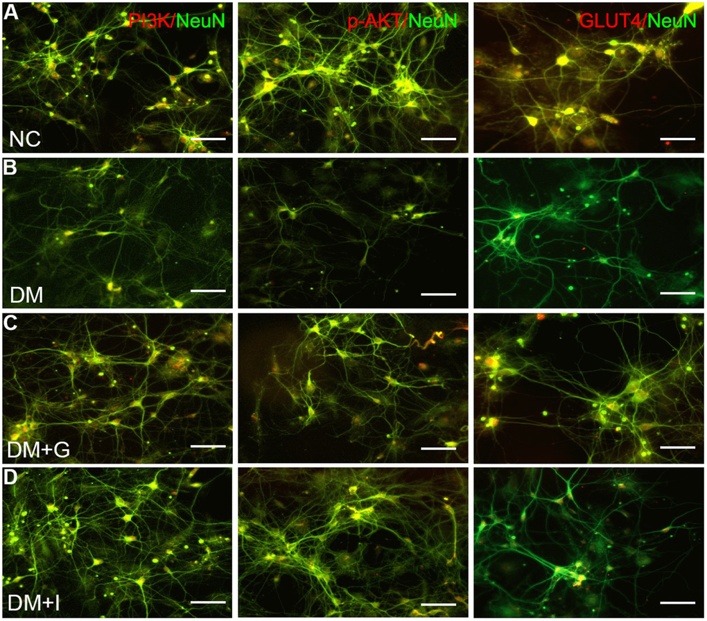 Gastrodin intervention and PAK2 inhibition restored the expression of PI3K/AKT/GLUT4 pathway in the primary hippocampal neurons exposed to high glucose. Double immunofluorescence staining of PI3K, p-AKT and GLUT4with NeuN in the primary hippocampal neurons of NC (A), DM (B), DM+G (C) and DM+I (D) groups. Bar = 50 μm.