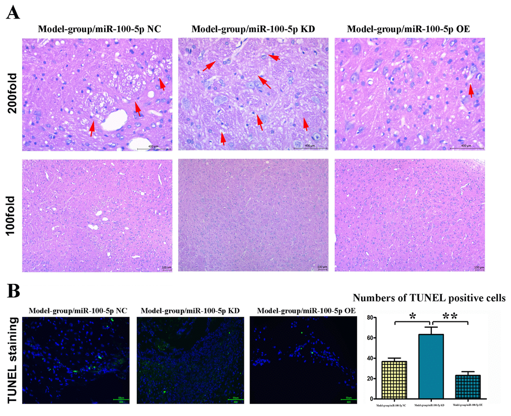 Overexpression of miR-100-5p could inhibit CI in mice. (A) HE staining results of the model, miR-100-5p KD, and miR-100-5p OE groups. In CI model group, a large number of ethmoid necrotic foci in ischemic cerebral tissue could be observed (arrowheads). The number of neurons in the necrotic foci was significantly reduced, with pyknosis and hyperchromatic nuclei; miR-100-5p KD aggravates the damage in cerebral while miR-100-5p OE attenuates the damage caused by CI. The CI volume was significantly reduced in the miR-100-5p OE group compared with the model group. (B) Overexpression of miR-100-5p inhibited apoptosis in the brain tissue of mice. TUNEL staining was performed, and the number of TUNEL-positive cells significantly declined in the miR-100-5p OE group compared with the model group. CI, cerebral infarction; HE, hematoxylin and eosin; NC, negative control; KD, knock down; OE, overexpression; TUNEL, terminal deoxynucleotidyl transferase (TdT) dUTP nick-end labeling. *PP