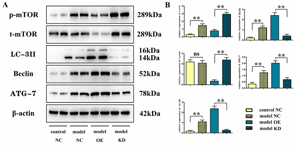 Overexpression of miR-100-5p decreased the protein expressions of phosphorylated mTOR and total mTOR but increasing the expression of autophagy-related proteins Beclin, LC-3II, and ATG-7 in vivo. (A) Representative Western blot images. (B) Column comparison of the relative expression of proteins. mTOR, mammalian target of the rapamycin; LC-3II, microtubule-associated protein light chain 3II; ATG-7, autophagy-related gene 7; NC, negative control; KD, knock down; OE, overexpression. *PP