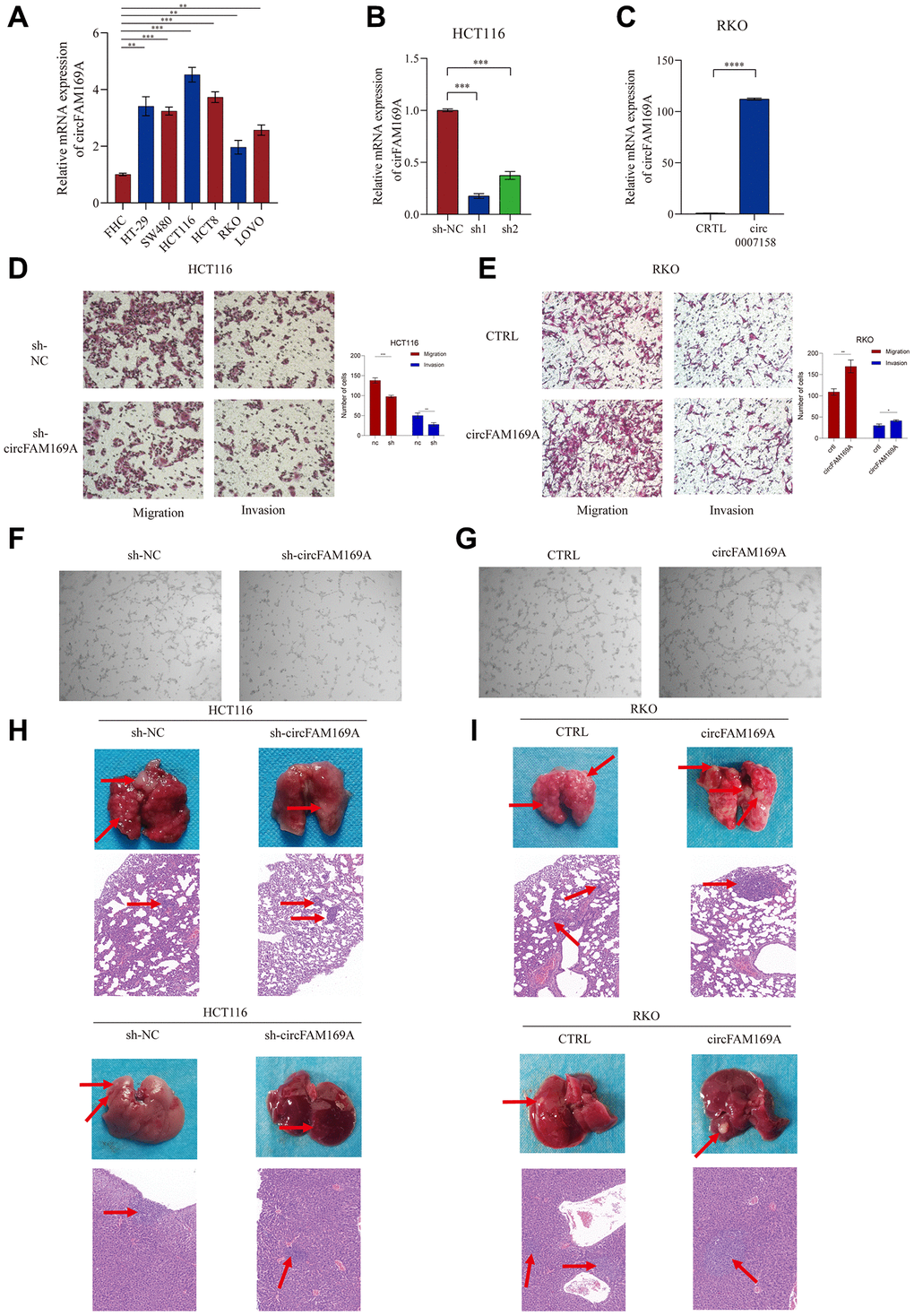 circFAM169A promotes CRC angiogenesis and metastasis in vitro and in vivo. (A) The expression of circFAM169A in FHC, HT29, SW480, HCT116, HCT8, LOVO, and RKO cells determined using qRT–PCR. All data are presented as means ± SD (n = 3 independent experiments). *p ≤ 0.05, **p ≤ 0.01, ***p ≤ 0.001, and ****p ≤ 0.0001. (B, C) Construction of stable inducible circFAM169A-knockdown or -overexpressed CRC cell lines. All data are presented as means ± SD (n = 3 independent experiments). ***p ≤ 0.001 and ****p ≤ 0.0001. (D, E) Transwell migration assay and Transwell invasion assay were performed using HCT116 and RKO cells. (F, G) An in vitro Matrigel tube formation assay was performed to evaluate the angiogenic ability of human umbilical vein endothelial cells (HUVECs). The representative micrographs are shown at 200× magnification. (H, I) Representative images and bar graphs of liver and lung metastases with circFAM169A-knocked down HCT116 cells (H) and circFAM169A-overexpressing SW480 cells (I) in a nude mouse metastatic tumor model.