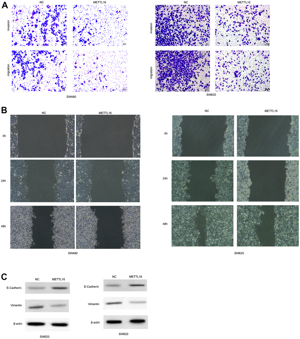 METTL16 regulates the migration and invasion of CRC cells. SW480 and SW620 cells were transfected with METTL16 overexpression vectors. (A) Cell migration and invasion were detected by using Transwell experiment. (B) Cell migration was measured by wound healing assay. (C) Protein levels of E-cadherin and Vimentin were detected by western blotting assay.
