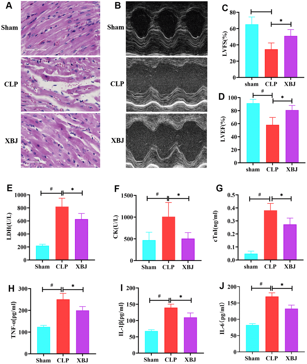 Effects of XBJ on myocardial damage and inflammation in rat after CLP. (A) Pathological changes of myocardial tissues under HE staining (200×). (B) Representative echocardiographic images. (C, D) Quantification of LVFS and LVEF via echocardiography. (E–G) XBJ improved myocardial dysfunction in rat after CLP: Serum levels of LDH (E), CK (F) and cTnI (G) detected by automated biochemical analyzer. (H–J) XBJ alleviated the myocardial inflammation in rat after CLP: Serum levels of TNF-α (H), IL-1β (I) and IL-6 (J) detected by ELISA. Data are expressed as mean ± SD (n = 6/group), # indicates pp