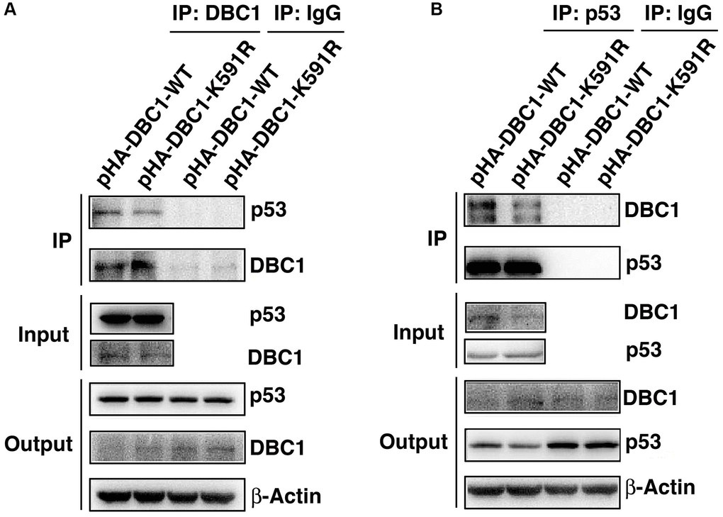 K591R mutant of DBC1 attenuates the interaction with p53. DBC1 KO cells were transiently transfected with DBC1-WT and DBC1-K591R mutant. (A) Their lysates were subjected to immunoprecipitation with anti-DBC1 antibody followed by immunoblot analysis as indicated. (B) Their lysates were subjected to immunoprecipitation with anti-p53 antibody followed by immunoblot analysis as indicated. Note that the K591R mutant of DBC1 weakens its interaction with p53.