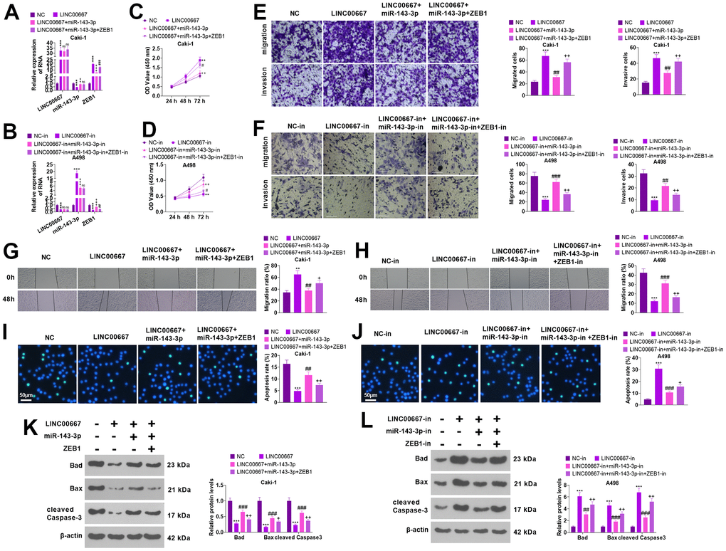 The regulation of the biological function of ccRCC cells by LINC00667-miR-143-3p-ZEB1 axis. Caki cells were transfected along with LINC00667 overexpression plasmids, miR-143-3p mimics and/or ZEB1 overexpression plasmids, while A498 cells were transfected together with LINC00667-in, miR-143-3p-in, and/or ZEB1-in. (A, B) LINC00667, miR-143-3p, and ZEB1 levels in Caki and A498 cells were tested via qRT-PCR. (C, D) Cell proliferation verified by CCK-8. (E, F) Migration and invasion in the cells were checked through Transwell. (G, H) Cell migration monitored by the wound healing test. Scale bar=100 μm. (I, J) Apoptosis gauged through TUNEL assay. Scale bar=50 μm. (K, L) The levels of apoptosis-concerned proteins were ascertained by WB. **PPP>0.05, ^^PP>0.05, #PPP