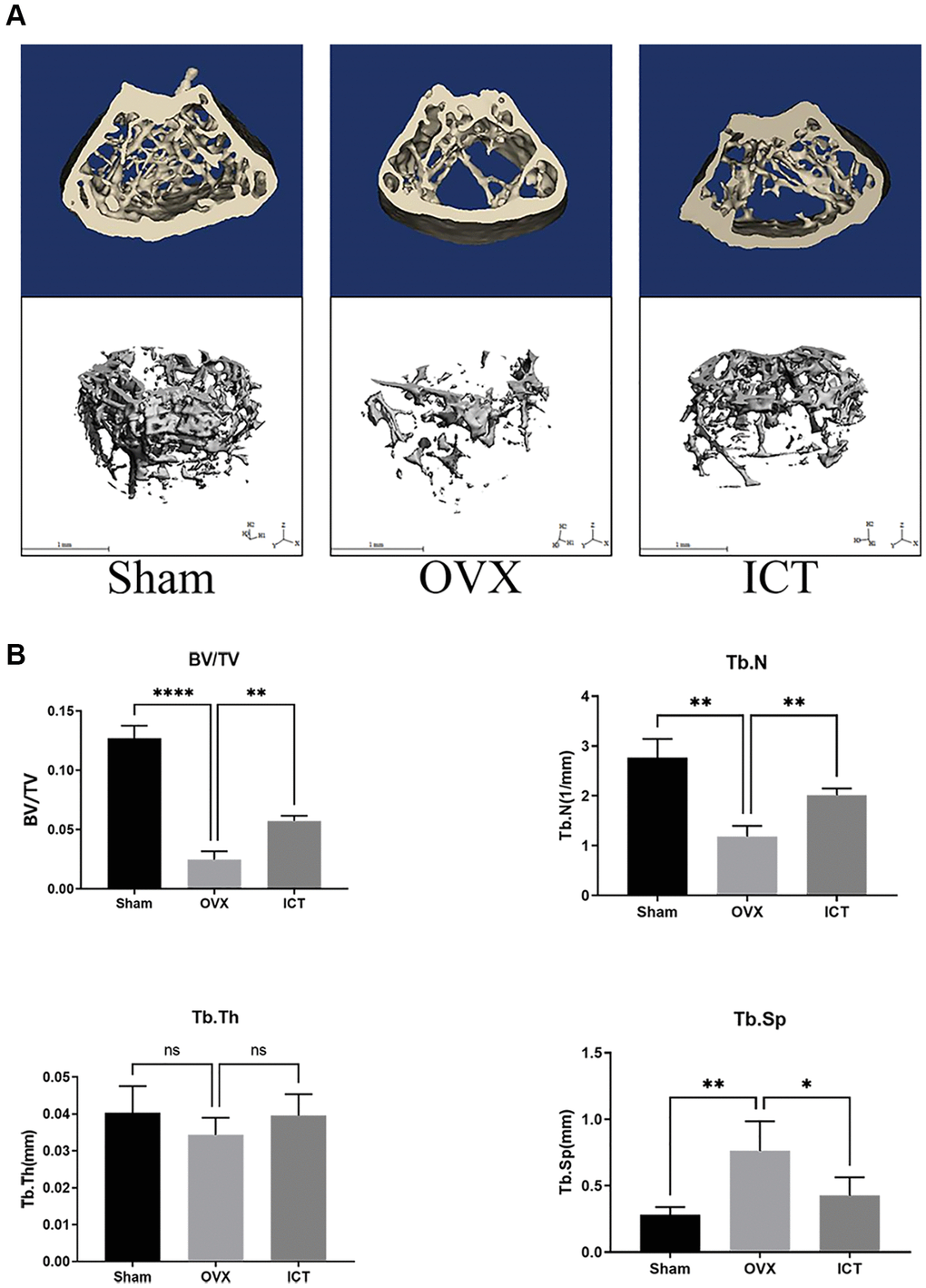 ICT suppresses OVX-induced bone loss. Twelve-week-old female mice were randomly arranged into three groups, that is Sham (Sham + Vehicle), OVX (OVX + Vehicle), and ICT (OVX + ICT). After being subjected to sham or OVX surgery, mice were treated with vehicle or ICT for 6 weeks. (A) Representative 3D reconstruction micro-CT images of the trabecular bone from each group. (B) The measurement data of BV/TV, Tb.Th, Tb.N, and Tb.Sp from each group through built-in software of CT system. All data were presented as mean ± SD, n = 6. Abbreviation: ns: not statistical significance. *P **P ****P 