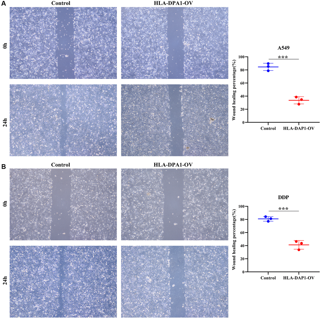 HLA-DPA1 overexpression inhibits LUAD cell migration. (A) A549; (B) A549/DDP. Abbreviation: LUAD: lung adenocarcinoma.