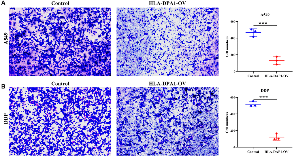 HLA-DPA1 overexpression inhibits LUAD cell invasion. (A) A549; (B) A549/DDP. Abbreviation: LUAD: lung adenocarcinoma.