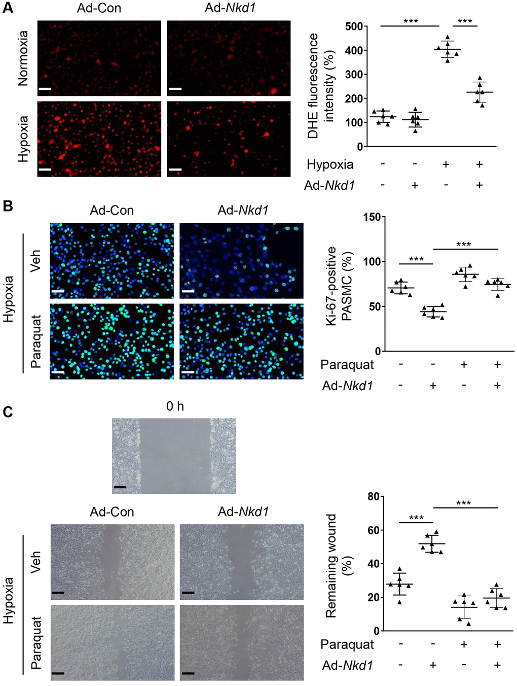 NKD1 suppresses hypoxia-induced proliferation and migration of PASMCs via inhibiting oxidative stress. (A) PASMCs were transfected with Ad-Con or Ad-Nkd1 and then cultured in the condition of normoxia or hypoxia. Above treated PASMCs were stained with DHE. Representative pictures and the corresponding quantification of DHE fluorescence intensity were shown (post hoc for LSD test; n = 6 samples). Bar = 50 μm. Hypoxia-challenged PASMCs were transfected with Ad-Con or Ad-Nkd1 and then cultured with or without paraquat treatment. (B) Above treated PASMCs were stained with Ki-67 (green) and DAPI (blue). Representative pictures and the corresponding percentage of Ki-67-positive PASMCs were shown (post hoc for LSD test; n = 6 samples). Bar = 50 μm. (C) Migration of above-treated PASMCs was assessed by wound-healing assay (post hoc for LSD test; n = 6 samples). Bar = 200 μm. Data were shown as mean ± S.D. ***P 