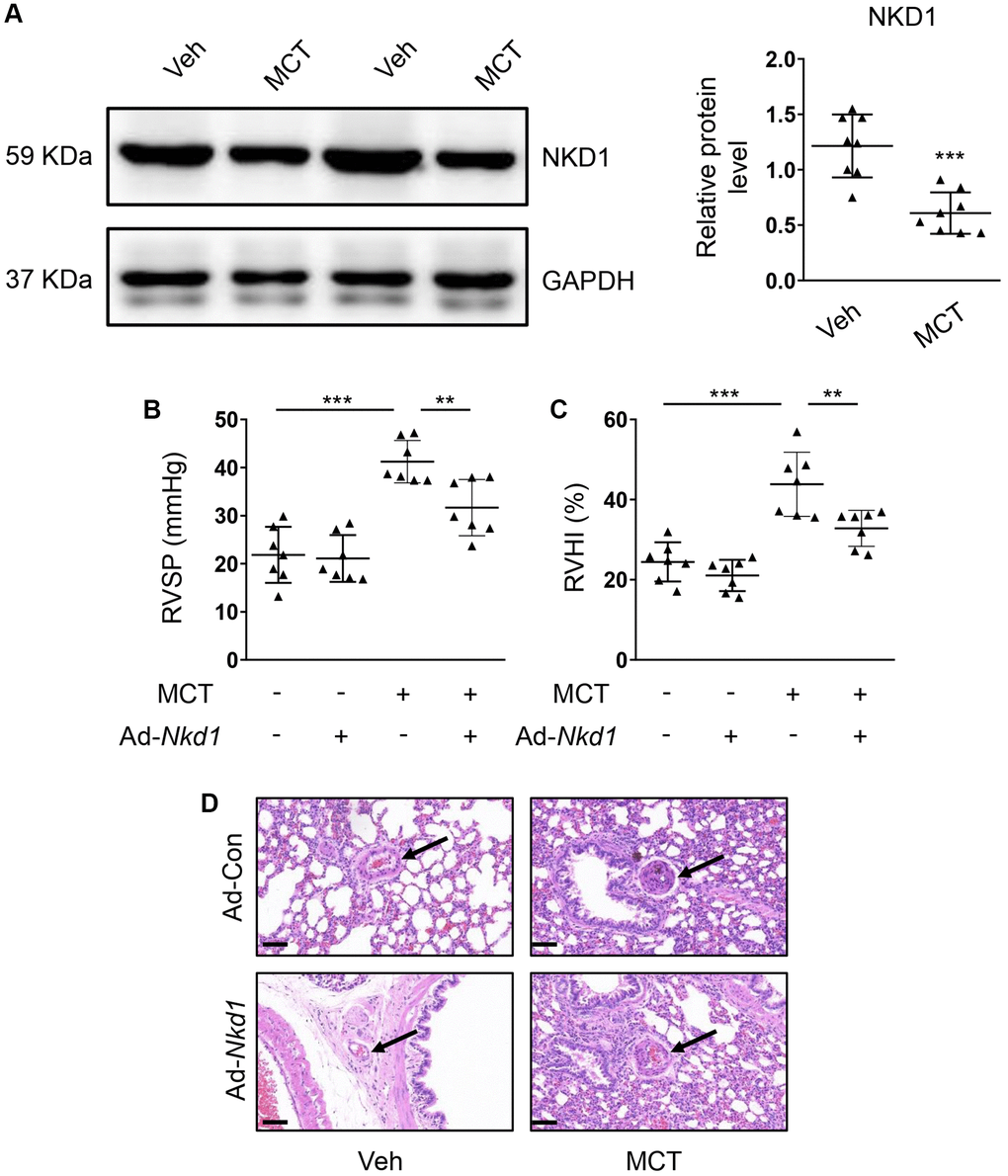 Upregulating NKD1 alleviates PAH symptoms in MCT-induced mouse PAH model. (A) The relative protein level of NKD1 in dissected PAs of MCT-treated mice was assessed by western blotting (post hoc for LSD test; n = 8 samples). RVSP (B) and RVHI (C) of MCT-treated mice were measured (post hoc for LSD test; n = 7 samples). RVSP indicates right ventricular systolic pressure. RVHI indicates right ventricular hypertrophy index. (D) Representative H-E staining pictures of lung tissues in vehicle- or MCT-treated mice after transfection of Ad-Con or Ad-Nkd1 were shown. The black arrows indicate peripheral PAs of lung tissues. Bar = 50 μm. Data were shown as mean ± S.D. **P ***P 