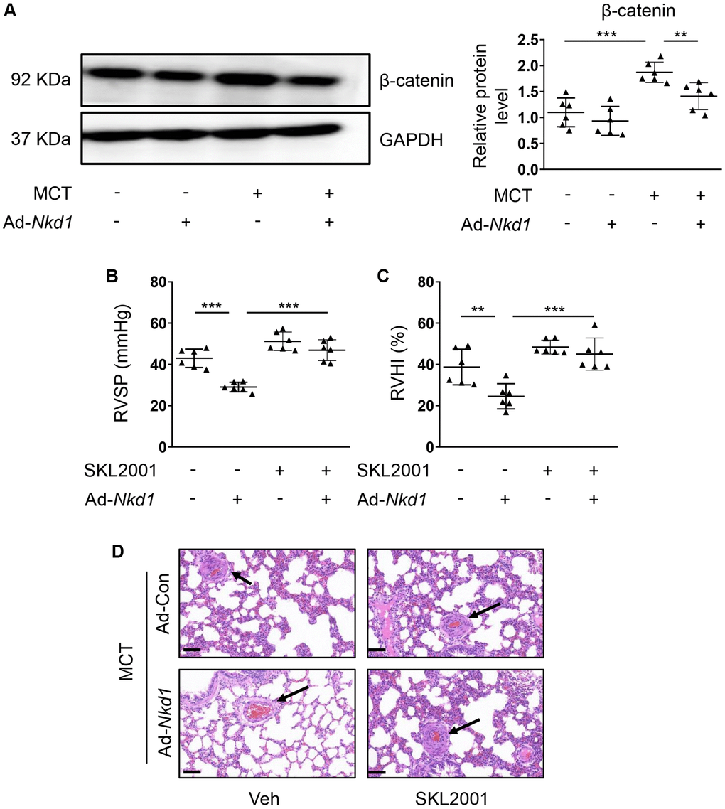 β-catenin is required for NKD1-mediated protection against PAH. (A) The relative protein level of β-catenin in dissected PAs of MCT-treated mice after transfection of Ad-Con or Ad-Nkd1 was assessed by western blotting (post hoc for LSD test; n = 6 samples). MCT-treated mice were transfected with Ad-Con or Ad-Nkd1 and treated with or without SKL2001. RVSP (B) and RVHI (C) of above-treated mice were measured (post hoc for LSD test; n = 6 samples). (D) Representative H-E staining pictures of lung tissues in above-treated mice were shown. The black arrows indicate peripheral PAs of lung tissues. Bar = 50 μm. Data were shown as mean ± S.D. **P ***P 