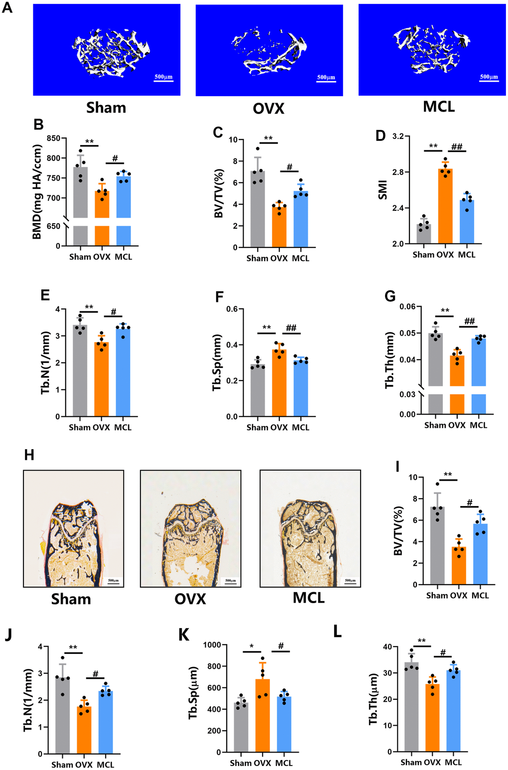 Micheliolide protected mice from OVX induced bone loss. Fifteen wild type female C57/BL6 mice aged 8 weeks were obtained and randomly split into three groups (n=5): Sham group (with Sham surgery and following with vehicle treatment), OVX group (with OVX surgery following with vehicle treatment), MCL group (with OVX operation following with Micheliolide treatment (30 mg/kg/day)). (A) Representative 3D micro-CT images of proximal femur. Scale bar = 500 μm. (B–G) Micro-CT values of BMD (mg HA/ccm), BV/TV (%), SMI, Tb.N (1/mm), Tb.Th (mm), and Tb.Sp (mm) were analyzed using the built-in software. (H) Representative Von Kossa staining of the histomorphological sections from each indicated group. (I–L) BV/TV, Tb.Th, Tb.N, and Tb.Sp of the Von Kossa staining sections from each group. All data: mean ± SD, n=5, *p 