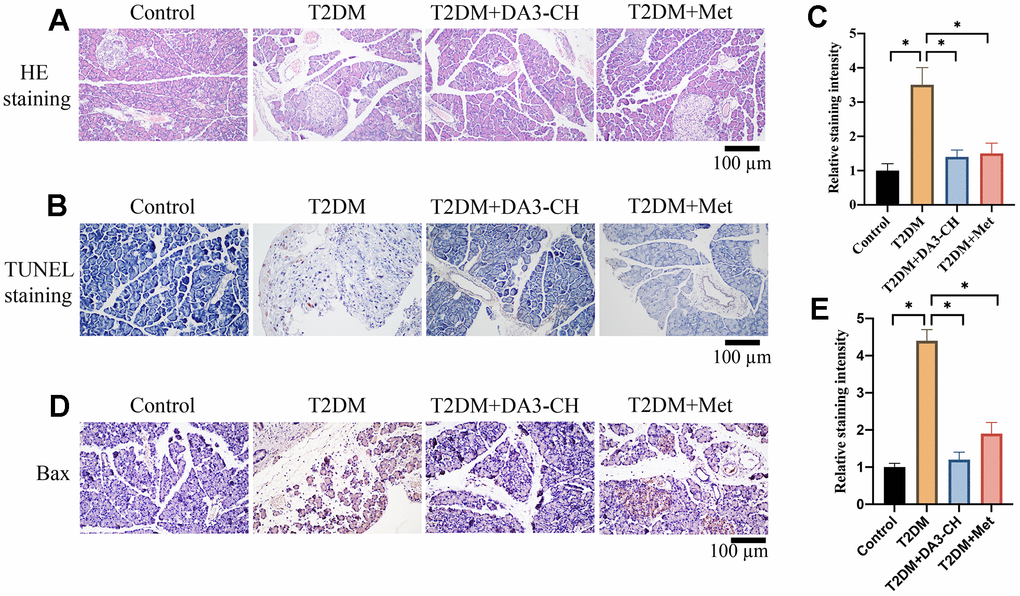 Significant tissue injury and apoptosis in pancreatic tissues of T2DM rats were inhibited by DA3-CH. (A) HE staining was performed to investigate the influence of DA3-CH on pancreatic tissue injury in vivo; (B) Tunel staining was performed to investigate the influence of DA3-CH on apoptosis level in vivo; (C) The staining intensity was analyzed; (D) IHC staining was performed to investigate the influence of DA3-CH on Bax expression in vivo; (E) The staining intensity was analyzed; * means p 