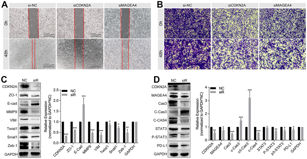 Inhibition of CDKN2A weakens tumor metastasis and immune escape in breast cancer. (A) Wound healing assay and (B) transwell assay show down-regulation of CDKN2A or MEGEA4 inhibits the cell migration ability. (C) WB detection shows down-regulation of CDKN2A decreases the expression level of ZO1, MMP9, VIM, Twist1, Snail1, and Zeb1, while E-cad is up-regulated. (D) Down-regulation of CDKN2A decreases the expression of MAGEA, Cas3, c-cas4, p-STAT3 and PD-L1, while c-cas3 is up-regulated.