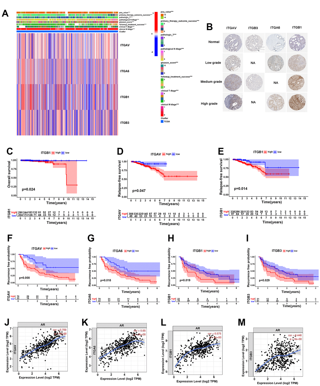 Integrin αvβ3/α6β1 were closely correlated with poor prognosis of PCa patients. (A) Heatmap of integrin αvβ3/α6β1 expression and clinical characteristics of 496 PCa patients in the TCGA cohort. (B) The immunohistochemistry of integrin αvβ3/α6β1 between normal prostate tissues and different grades of PCa tissues in the Human Protein Atlas (HPA). (C) Kaplan-Meier analysis of the OS of patients with high and low ITGB1 expression in the TCGA cohort. (D, E) Kaplan-Meier analysis of the RFS of patients with high and low ITGAV (D) and ITGB1 (E) expression in the TCGA cohort. (F–I) Kaplan-Meier analysis of the biochemical recurrence of patients with high and low ITGAV, ITGA6, ITGB1, and ITGB3 expression in the TCGA cohort. (J–M) Correlations between ITGAV, ITGA6, ITGB1, ITGB3 and androgen receptor (AR).