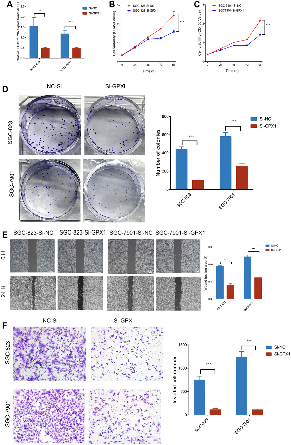 The impact of GPX1 on the migration, invasion, and proliferation of gastric cancer cells. (A) Relative expression of GPX1 detected by qPCR in SGC-823 and SGC-7901 cells (n=3). Cell viability of (B) SGC-823 and (C) SGC-7901 cells after being treated with Si-NC and Si-GPX1 (n=3). (D) Clone formation experiments (n=3). (E) Scratch assays. (n=3) (×40). (F) The numbers of SGC-823 and SGC-7901 cells that traversed the transwell membrane (n=3) (×200).