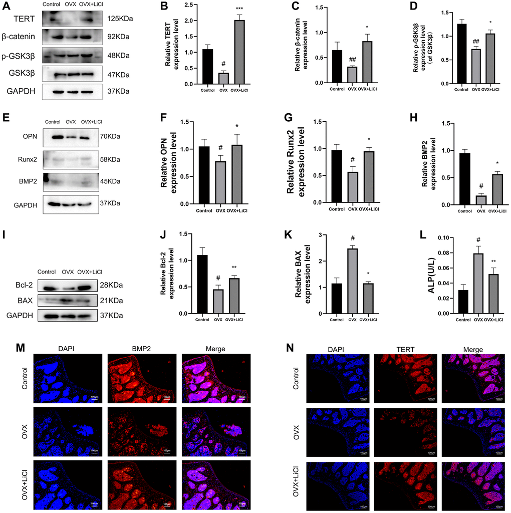 LiCl reverses the inactivation of Wnt pathway, increases osteogenic capacity, and reduces apoptosis levels in OVX mice. (A–K) Western blotting and quantification of TERT, β-catenin, p-GSK3β/GSK3β, OPN, Runx2, BMP2, Bcl-2, and BAX expression levels in the sham, OVX, and OVX+LiCl group mice. (L) ALP activity detected by ALP activity assay kit in three groups of mice. (M, N) The representative pictures of immunofluorescence staining (original magnification, ×400) and their analyses showed the expressions of BMP2 and TERT in mice femurs. All results are performed as mean ± SD. #P ##P *P **P ***P n = 6.
